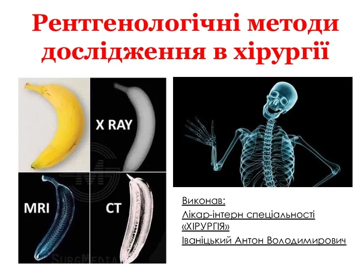 Виконав: Лікар-інтерн спеціальності «ХІРУРГІЯ» Іваніцький Антон Володимирович Рентгенологічні методи дослідження в хірургії