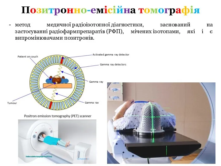 Позитронно-емісійна томографія метод медичної радіоізотопної діагностики, заснований на застосуванні радіофармпрепаратів