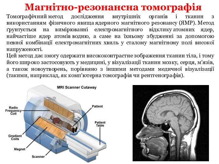 Магнітно-резонансна томографія Томографічний метод дослідження внутрішніх органів і тканин з