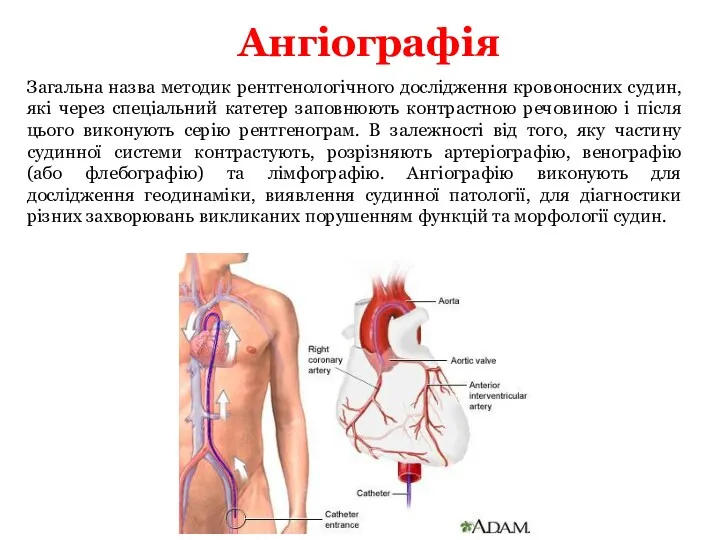 Ангіографія Загальна назва методик рентгенологічного дослідження кровоносних судин, які через