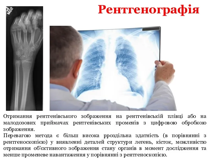 Рентгенографія Отримання рентгенівського зображення на рентгенівській плівці або на малодозових