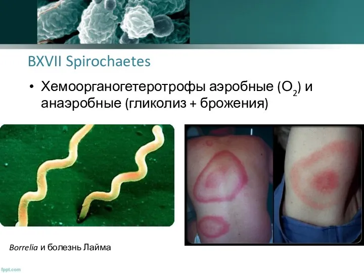 BXVII Spirochaetes Хемоорганогетеротрофы аэробные (О2) и анаэробные (гликолиз + брожения) Borrelia и болезнь Лайма
