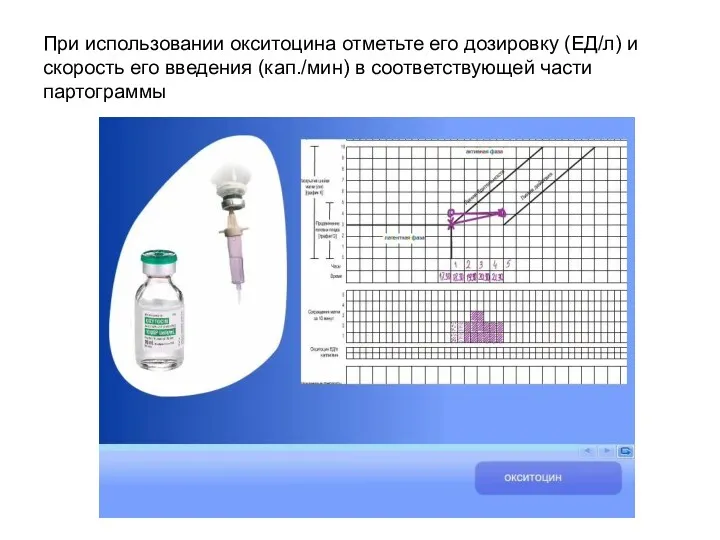 При использовании окситоцина отметьте его дозировку (ЕД/л) и скорость его введения (кап./мин) в соответствующей части партограммы