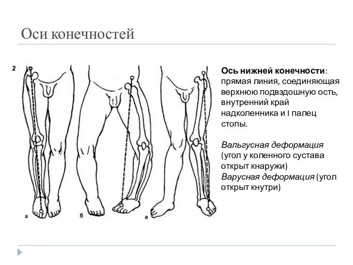 Оси конечностей Ось нижней конечности: прямая линия, соединяющая верхнюю подвздошную