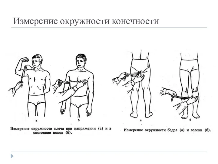 Измерение окружности конечности