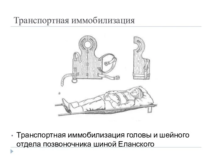 Транспортная иммобилизация Транспортная иммобилизация головы и шейного отдела позвоночника шиной Еланского