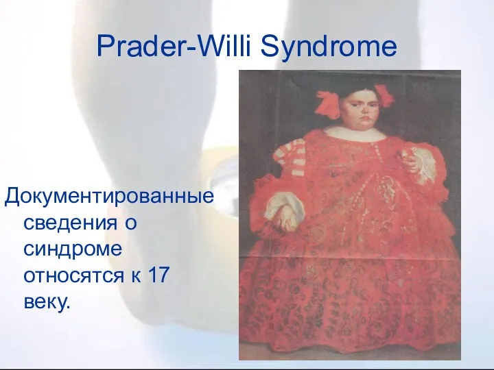 Документированные сведения о синдроме относятся к 17 веку. Prader-Willi Syndrome