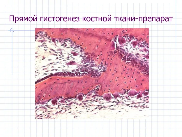 Прямой гистогенез костной ткани-препарат