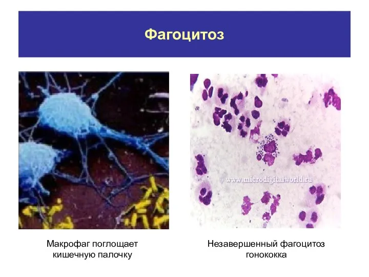 Макрофаг поглощает кишечную палочку Незавершенный фагоцитоз гонококка Фагоцитоз