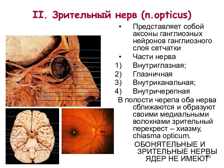 II. Зрительный нерв (n.opticus) Представляет собой аксоны ганглиозных нейронов ганглиозного