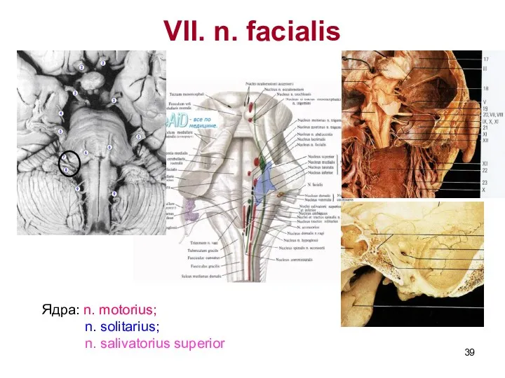 VII. n. facialis Ядра: n. motorius; n. solitarius; n. salivatorius superior