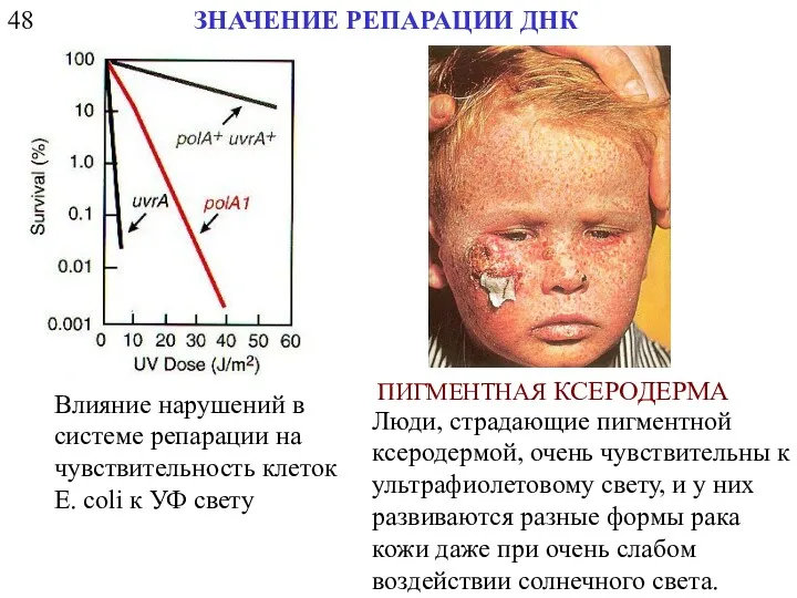 48 ЗНАЧЕНИЕ РЕПАРАЦИИ ДНК ПИГМЕНТНАЯ КСЕРОДЕРМА Люди, страдающие пигментной ксеродермой,