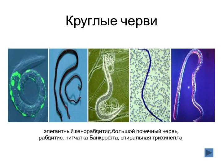 элегантный кенорабдитис,большой почечный червь, рабдитис, нитчатка Банкрофта, спиральная трихинелла. Круглые черви