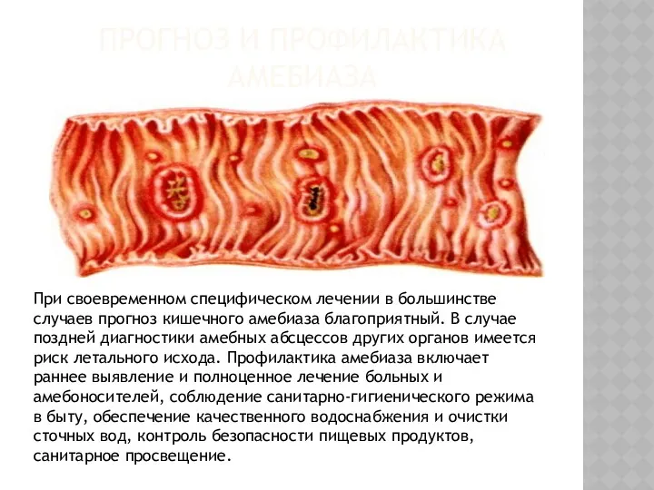 ПРОГНОЗ И ПРОФИЛАКТИКА АМЕБИАЗА При своевременном специфическом лечении в большинстве