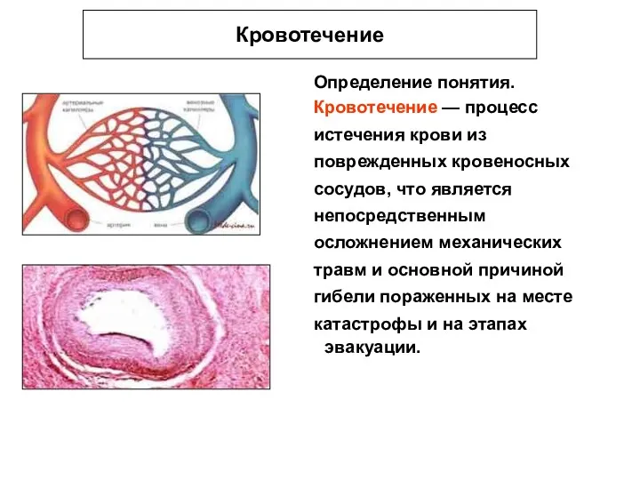 Кровотечение Определение понятия. Кровотечение — процесс истечения крови из поврежденных