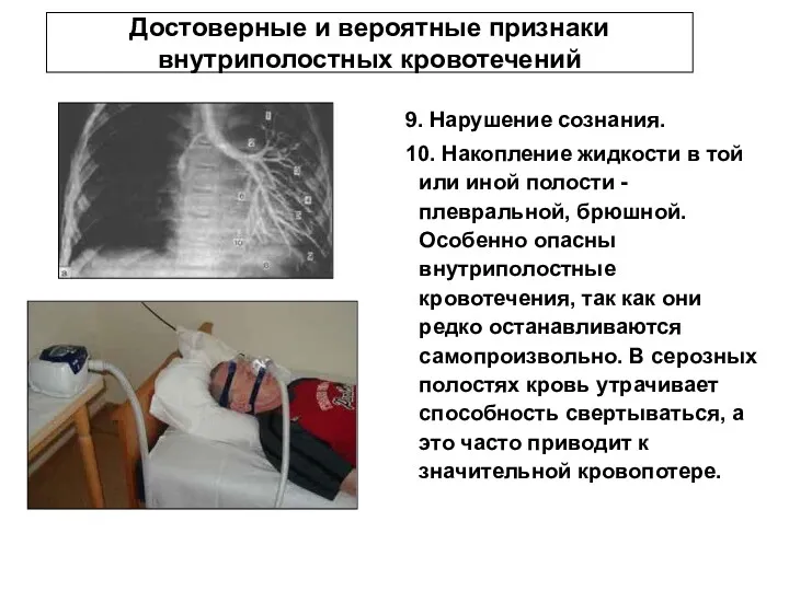 Достоверные и вероятные признаки внутриполостных кровотечений 9. Нарушение сознания. 10.