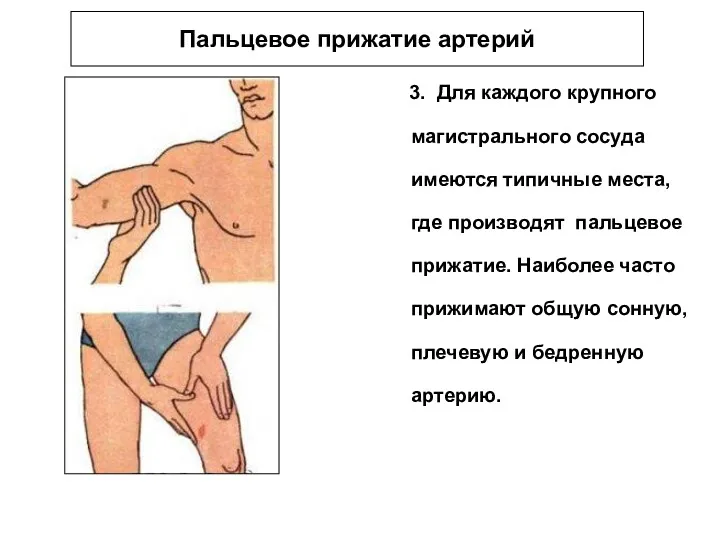 Пальцевое прижатие артерий 3. Для каждого крупного магистрального сосуда имеются