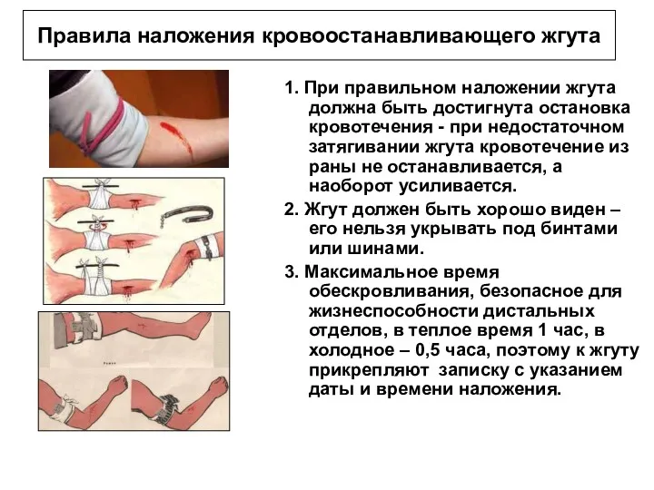 Правила наложения кровоостанавливающего жгута 1. При правильном наложении жгута должна