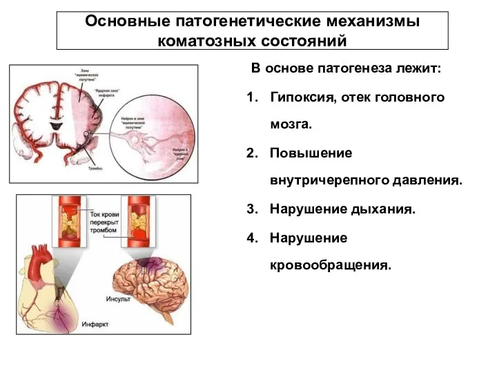 Основные патогенетические механизмы коматозных состояний В основе патогенеза лежит: Гипоксия,