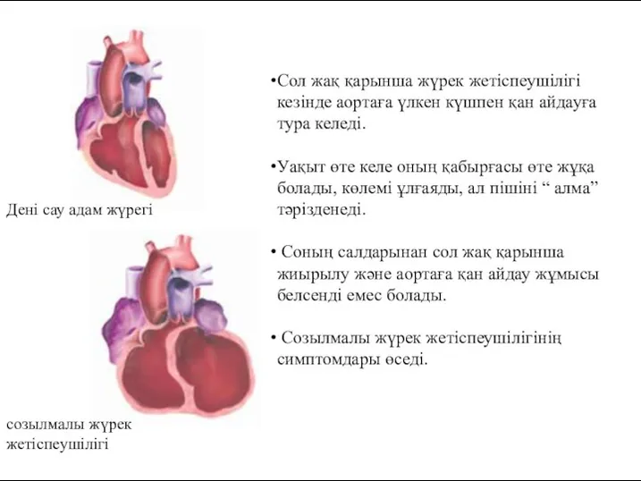 Дені сау адам жүрегі созылмалы жүрек жетіспеушілігі Сол жақ қарынша