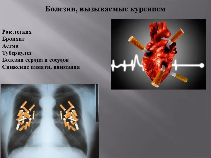 Рак легких Бронхит Астма Туберкулез Болезни сердца и сосудов Снижение памяти, внимания Болезни, вызываемые курением