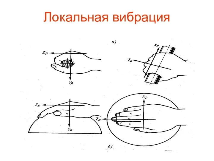 Локальная вибрация