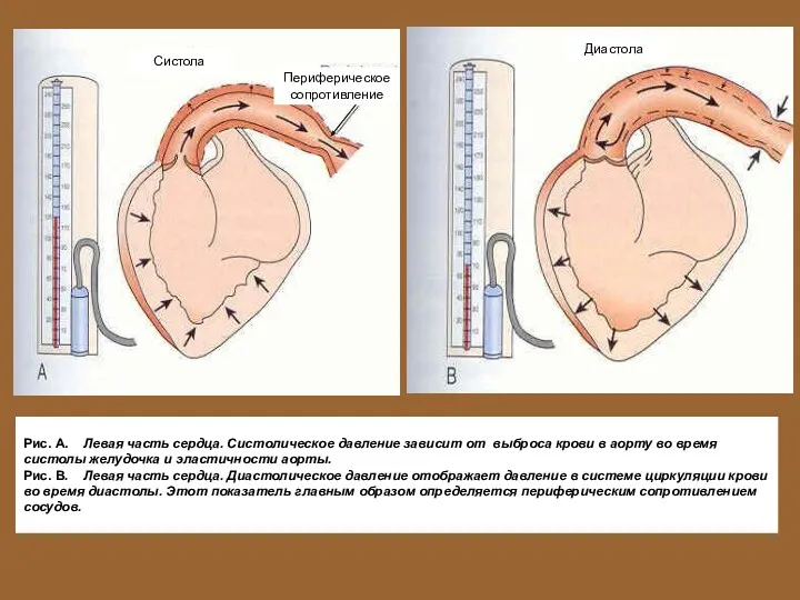Рис. А. Левая часть сердца. Систолическое давление зависит от выброса