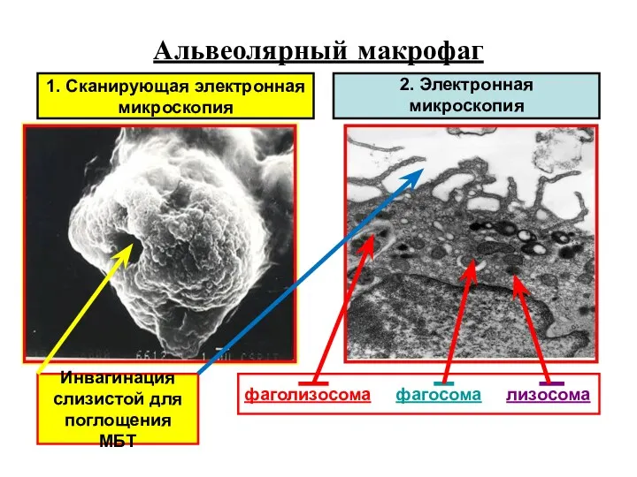 Альвеолярный макрофаг 2. Электронная микроскопия 1. Сканирующая электронная микроскопия фаголизосома фагосома лизосома Инвагинация