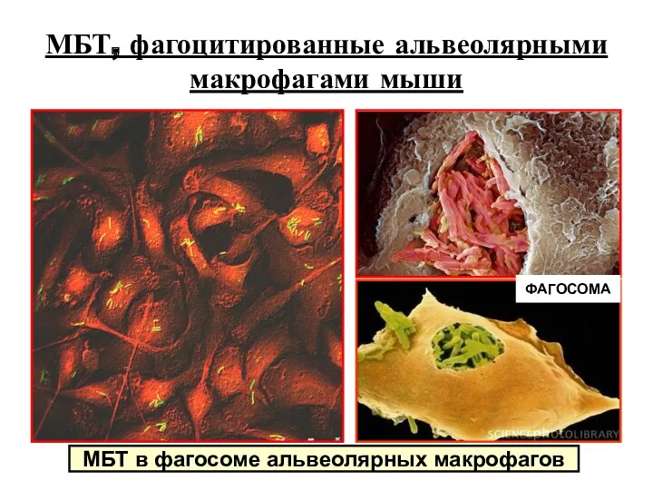 МБТ, фагоцитированные альвеолярными макрофагами мыши МБТ в фагосоме альвеолярных макрофагов ФАГОСОМА