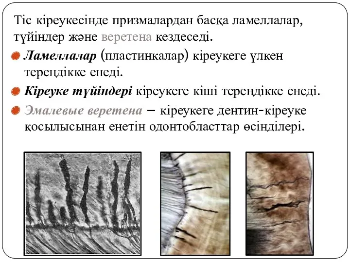 Тіс кіреукесінде призмалардан басқа ламеллалар, түйіндер және веретена кездеседі. Ламеллалар