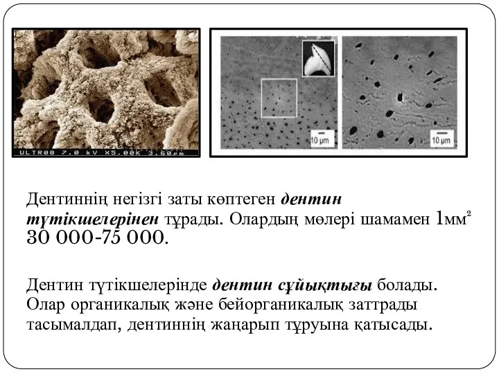 Дентиннің негізгі заты көптеген дентин түтікшелерінен тұрады. Олардың мөлері шамамен