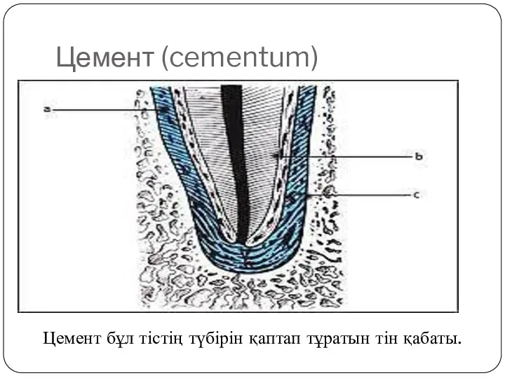 Цемент (cementum) Цемент бұл тістің түбірін қаптап тұратын тін қабаты.