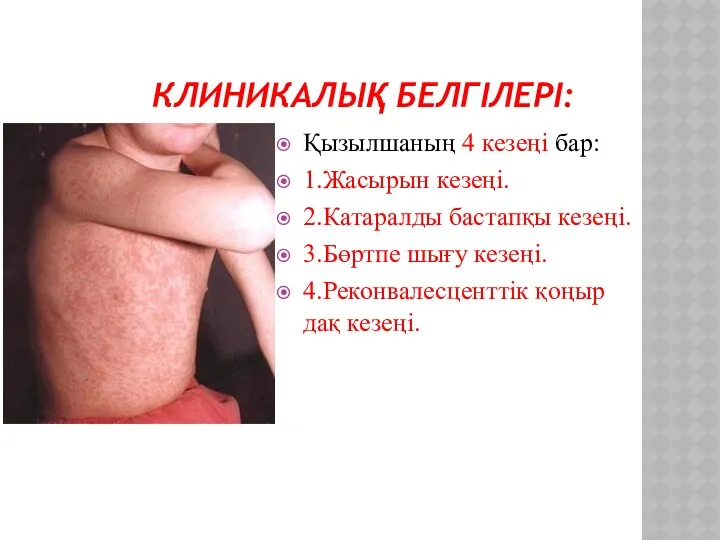 КЛИНИКАЛЫҚ БЕЛГІЛЕРІ: Қызылшаның 4 кезеңі бар: 1.Жасырын кезеңі. 2.Катаралды бастапқы