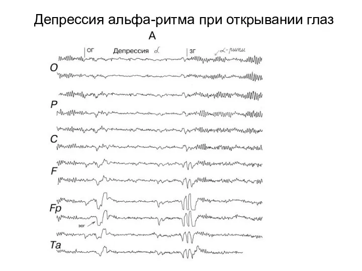 Депрессия альфа-ритма при открывании глаз