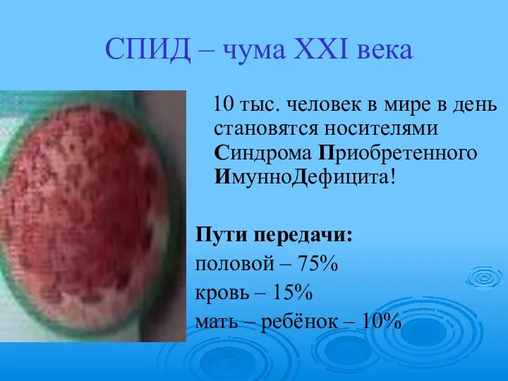 СПИД – чума XXI века 10 тыс. человек в мире в день становятся