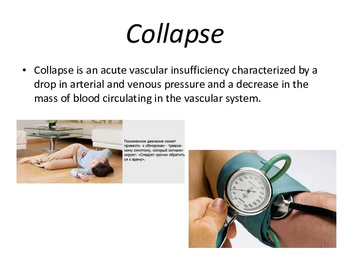 Collapse Collapse is an acute vascular insufficiency characterized by a