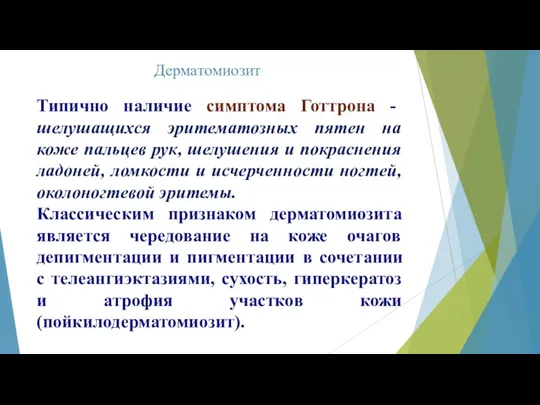 Дерматомиозит Типично наличие симптома Готтрона - шелушащихся эритематозных пятен на