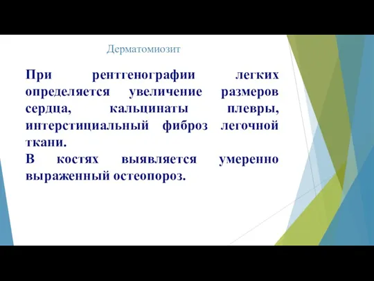 Дерматомиозит При рентгенографии легких определяется увеличение размеров сердца, кальцинаты плевры,