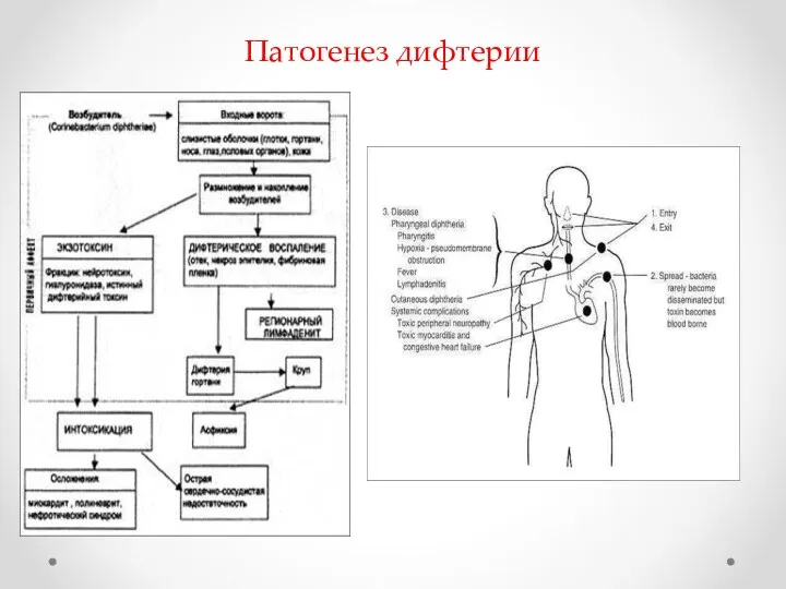 Патогенез дифтерии