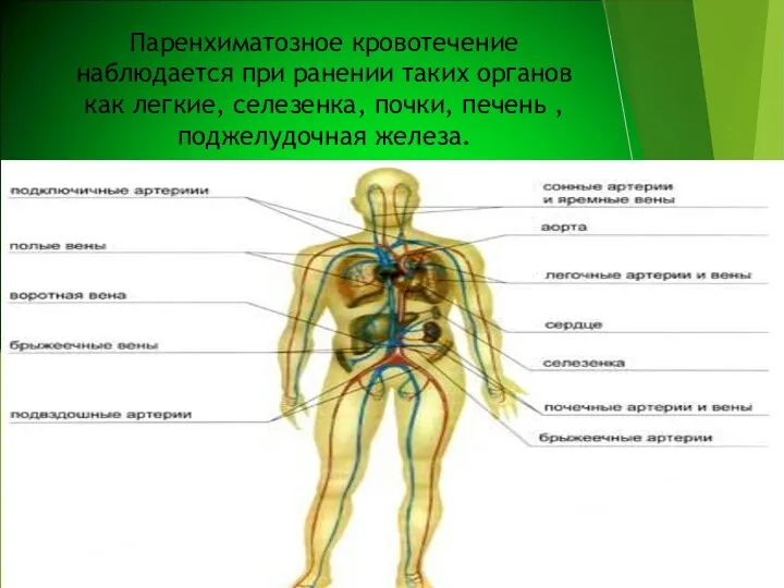 Паренхиматозное кровотечение наблюдается при ранении таких органов как легкие, селезенка, почки, печень , поджелудочная железа.