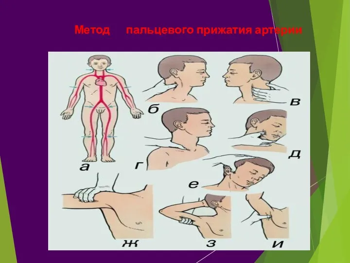 Метод пальцевого прижатия артерии