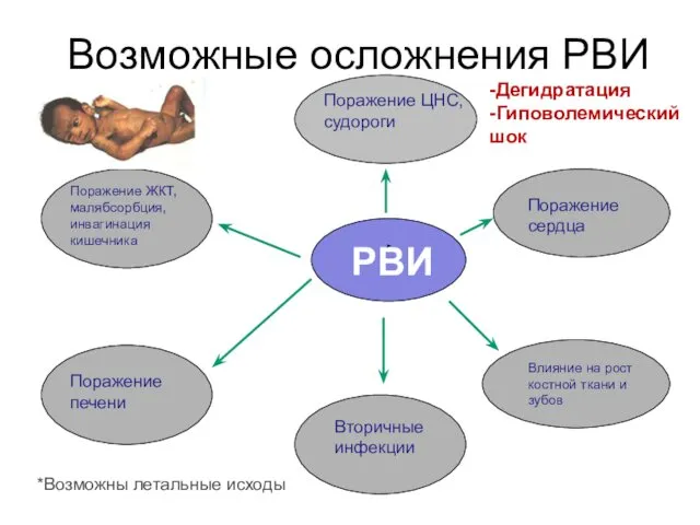 Возможные осложнения РВИ *Возможны летальные исходы РВИ Поражение ЦНС, судороги