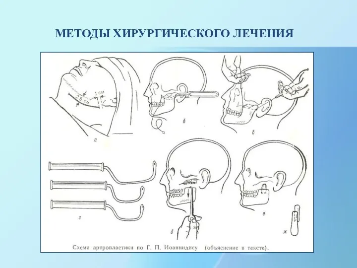 МЕТОДЫ ХИРУРГИЧЕСКОГО ЛЕЧЕНИЯ