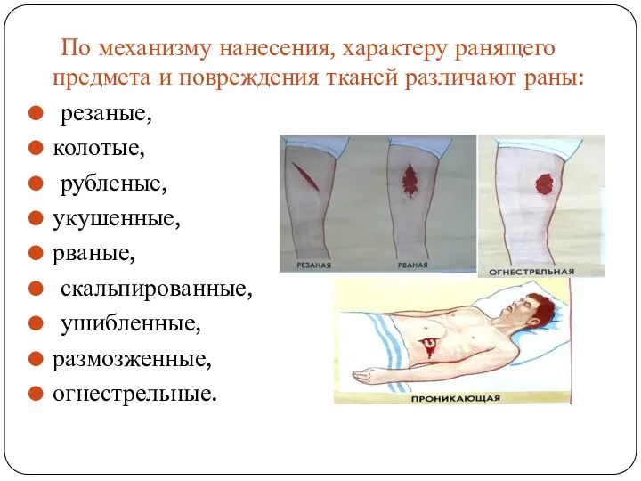 По механизму нанесения, характеру ранящего предмета и повреждения тканей различают раны: резаные, колотые,