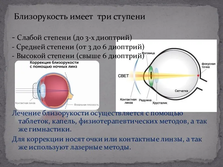 Лечение близорукости осуществляется с помощью таблеток, капель, физиотерапевтических методов, а