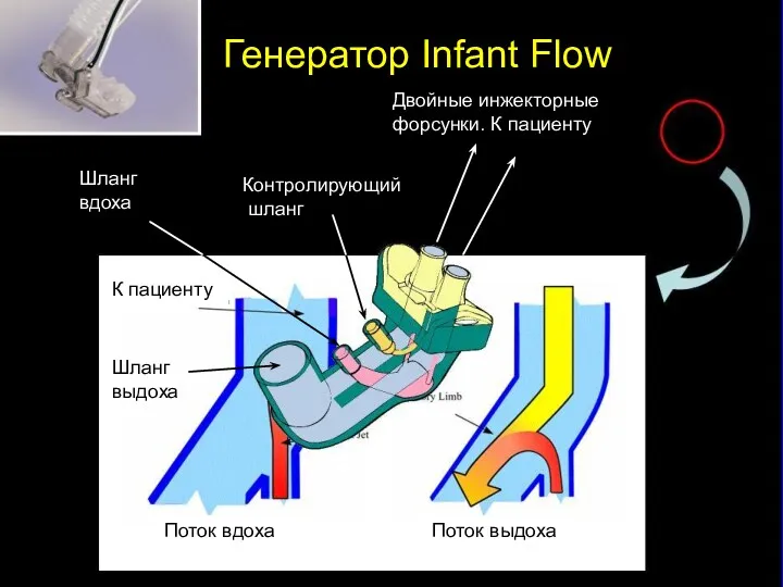 Генератор Infant Flow Поток вдоха Поток выдоха К пациенту Двойные
