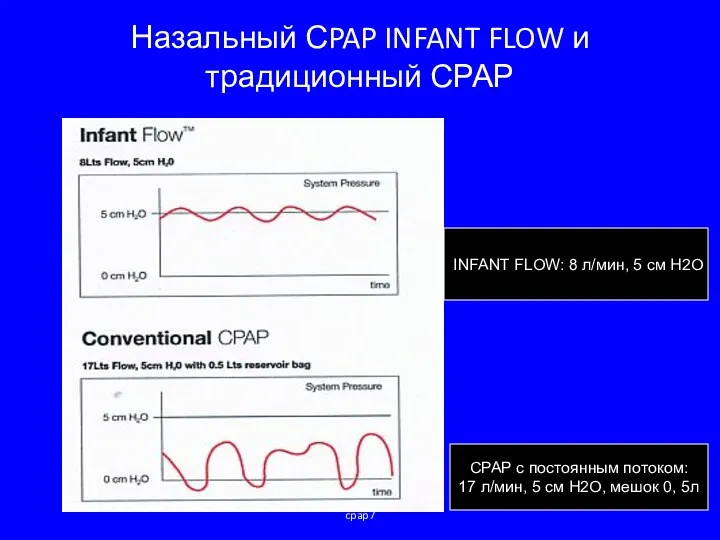 cpap7 Назальный СPAP INFANT FLOW и традиционный СРАР INFANT FLOW: