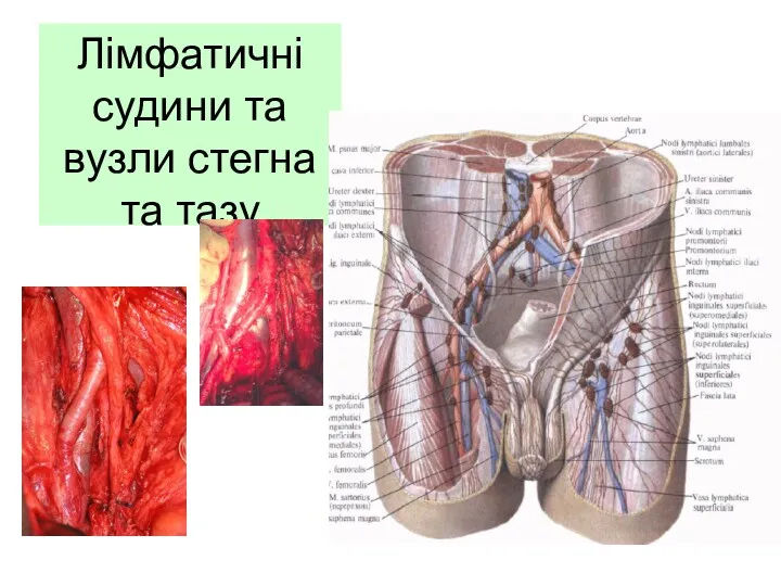 Лімфатичні судини та вузли стегна та тазу