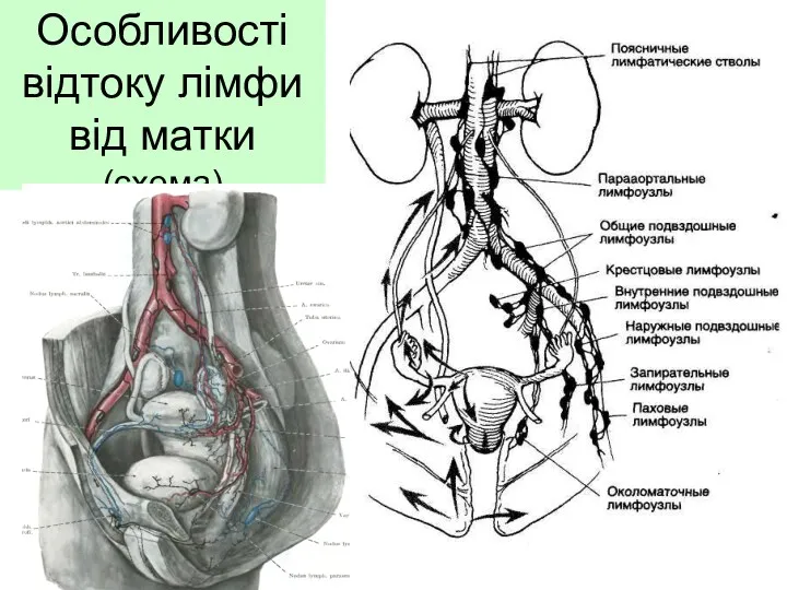 Особливості відтоку лімфи від матки (схема)