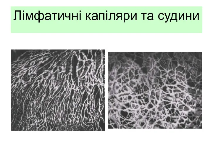 Лімфатичні капіляри та судини